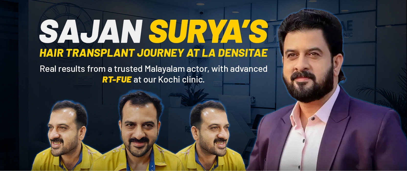 sajan surya hair transplant